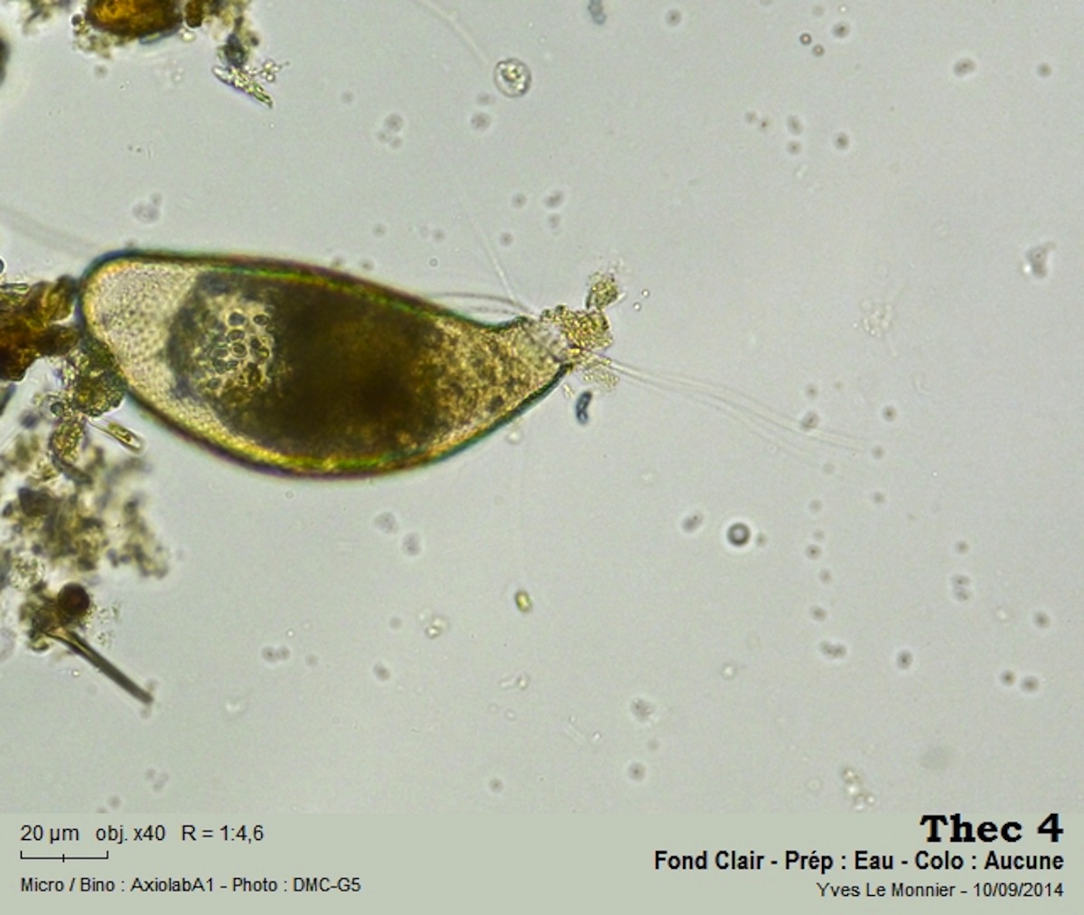 Cyphoderia ampulla (Erhenberg, 1840).jpg