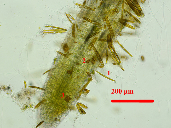 Diatomées sur racine de lentille d’eau :<br />1 – Eunotia   2 – Meridion   3 – Eunotia encore
